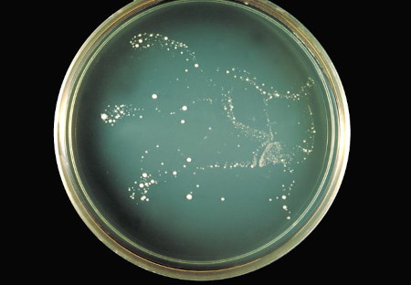 Cryptococcus neoformans