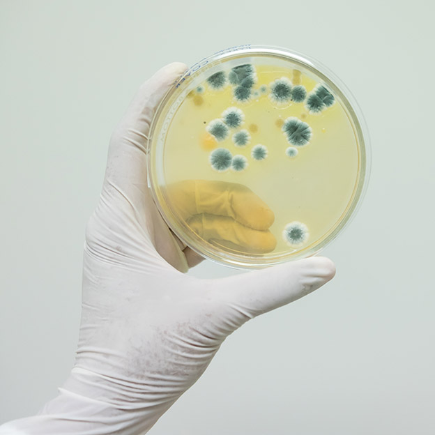 Fungal culture in petri dish