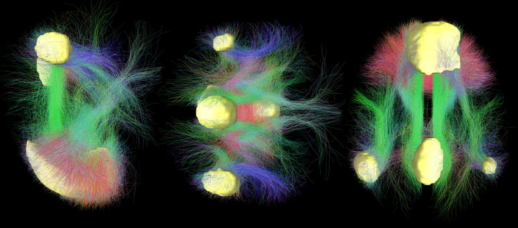 Conectividad estructural de la Red Neuronal por Defecto (DMN). 
Las áreas en amarillo representan los nodos principales asociados 
a la narrativa del yo y la memoria autobiográfica.