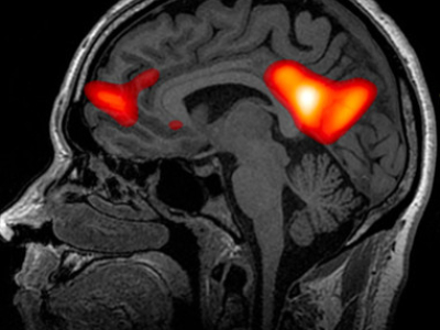 Therapeutic applications of psilocybin
